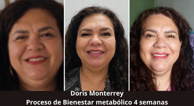 Doris, proceso de bienestar metab&oacute;lico de 4 semanas